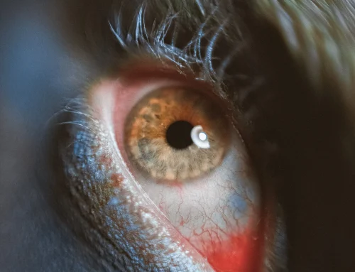 Les yeux qui grattent : quand et comment réagir ?